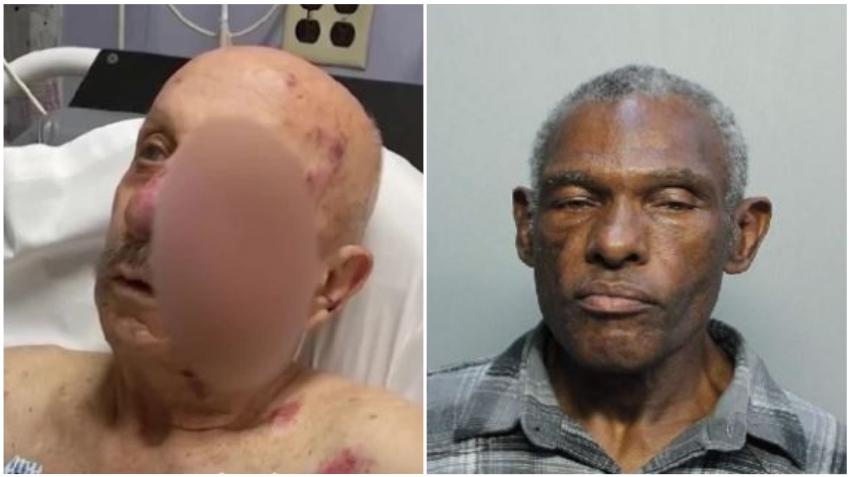 Hombre que propinó brutal paliza a anciano en el metromover de Miami es declarado culpable en segundo juicio