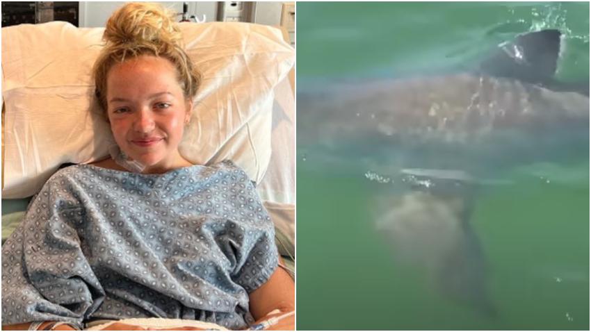 Joven de 17 años que fue atacada por un tiburón en Florida perderá la pierna