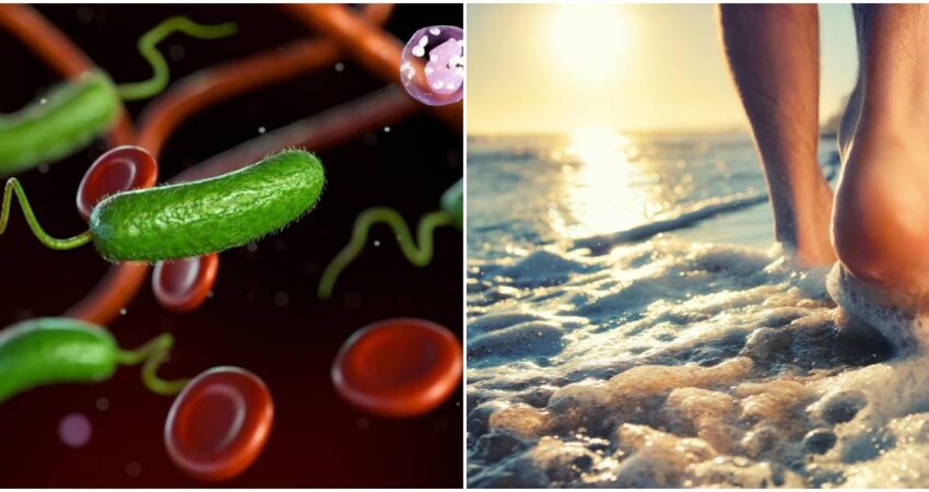 Vibrio vulnificus-piernas en la playa